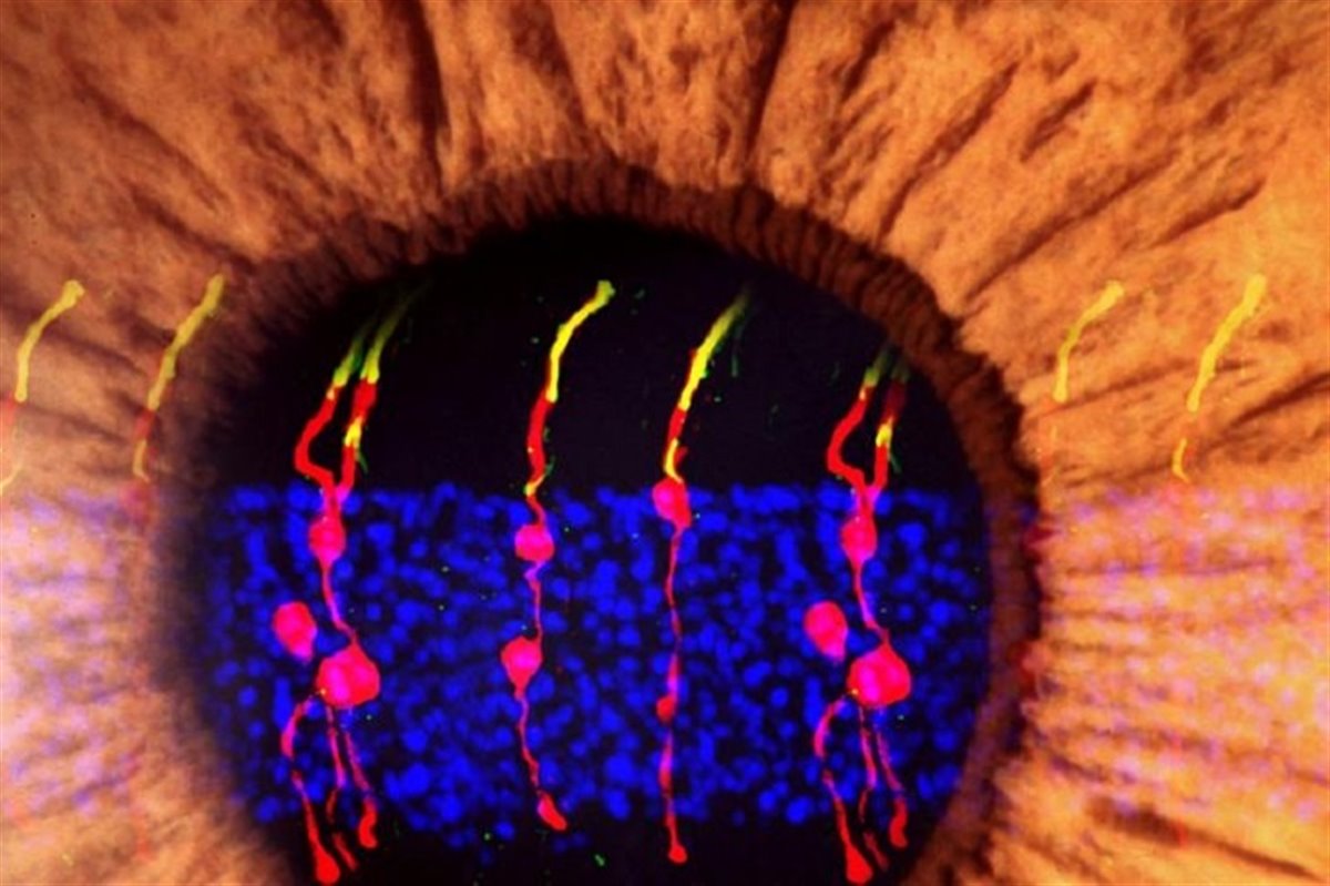 درمان نابینایی با برنامه ریزی مجدد سلول های شبکیه