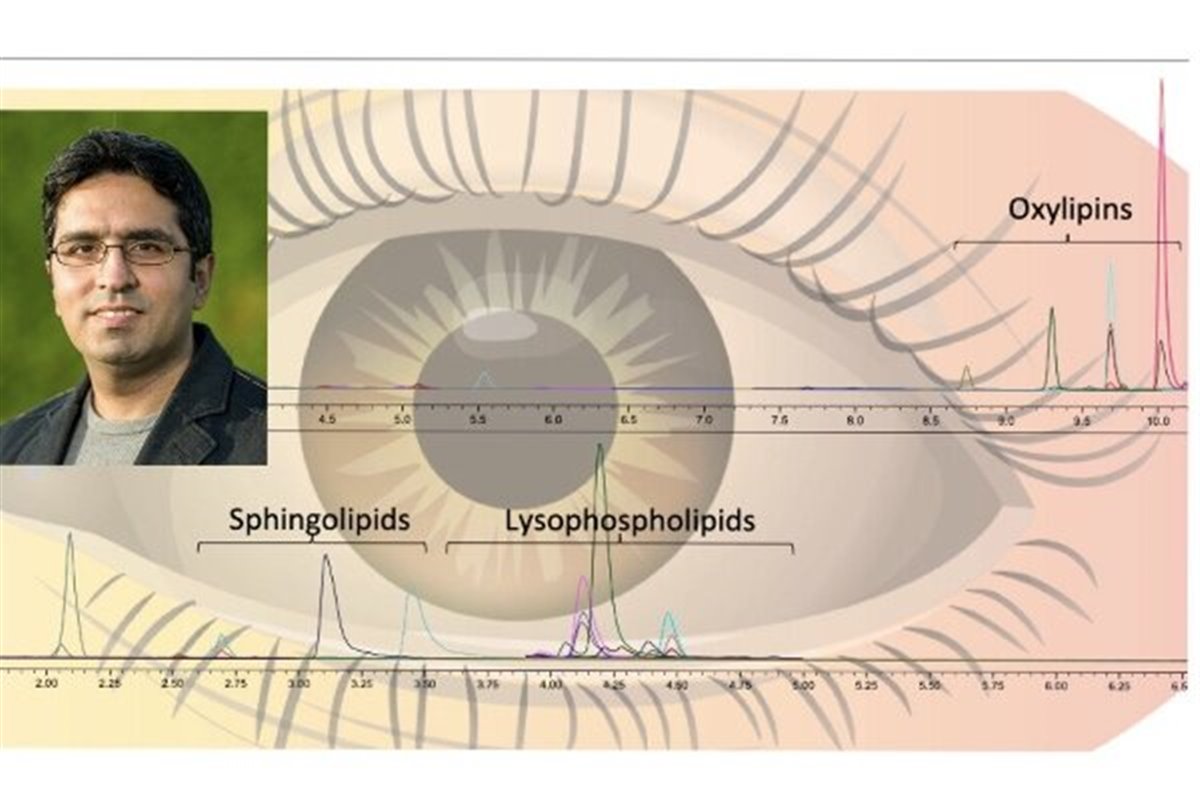 روش ابداعی محقق ایرانی برای تشخیص بیماری های چشمی