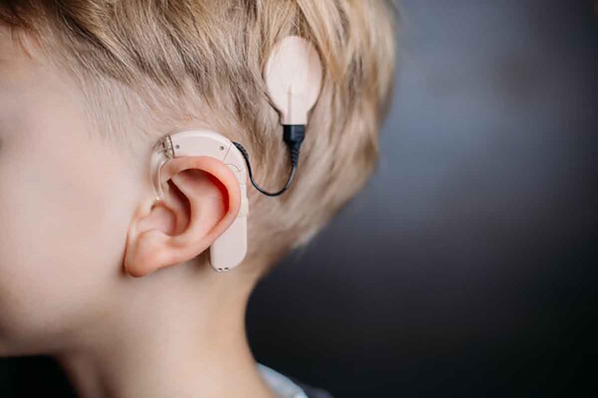 کدام بیماران به کاشت حلزون شنوایی نیاز دارند؟