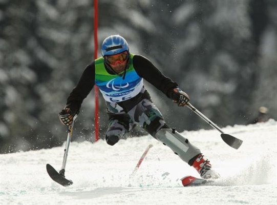 اسکی‌بازی که پایش را از دست داد اما امیدش را نه!