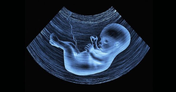 انجام غربالگری‌های بارداری موجب کاهش تولد نوزاد معلول می‌شود